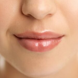 Blog 1 Lip Fillers Injections in Abu Dhabi