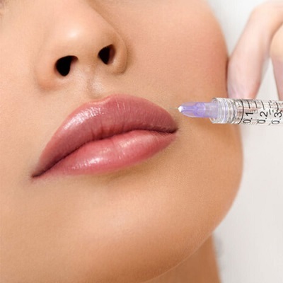 Lip Fillers Offers in Abu Dhabi Al Ain Price Cost