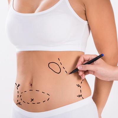 Liposuction Cost in Abu Dhabi | Remove Fat Enfiled Royal