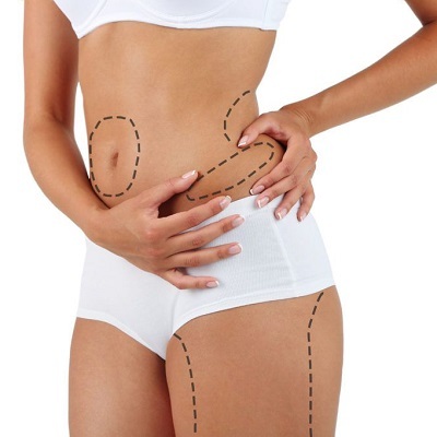 Lower Body Lift 2 Lower Bod Lift in Abu Dhabi khalifa City Al Ain Cost Price