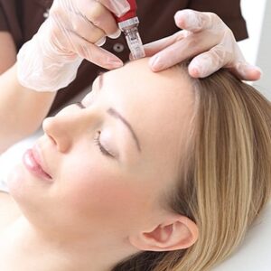 Micro needling with PRP Benefits in Abu Dhabi Al Ain