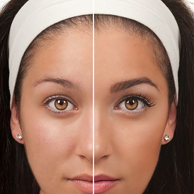 Neograft-Hair-Transplant-for-Eyebrows-Abu-Dhabi-Al-Ain