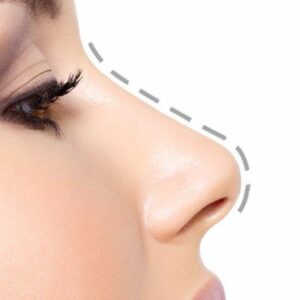 Blog 13 Non surgical Rhinoplasty Cost In Abu Dhabi Al Ain