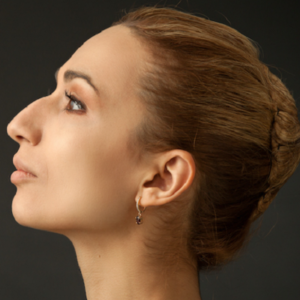 Blog 1 Nose Tip Plasty Clinic in Abu Dhabi & Al Ain