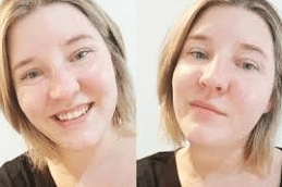 Oxygen-facial-Clinic-in-Abu-Dhabi-Al-Ain.