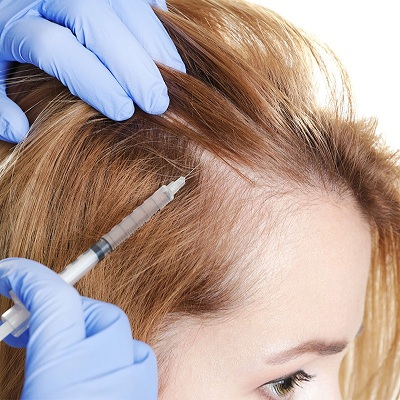 PRP Hair Therapy Cost in Abu Dhabi 12 PRP hair therapy in Abu Dhabi Al Ain
