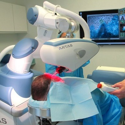 Robotic Hair Transplant 2 Robotic-Hair-Transplant in Abu Dhabi Al Ain Cost Deals