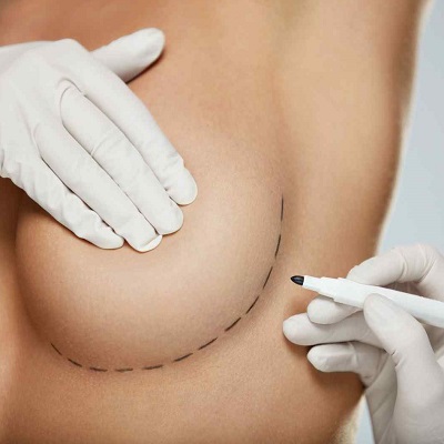Short Scar Breast Augmentation in Abu Dhabi & Al Ain Implant Cost