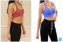 ShortScar Breast Augmentatuion