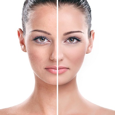 Skin Rejuvenation Treatments 2 Skin Rejuvenation Treatment in Abu Dhabi khalifa City & Al Ain | Cost