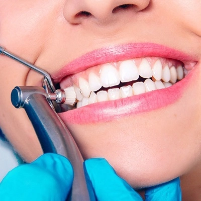 Teeth Cleaning 2 Teeth Cleaning in Abu Dhabi & Al Ain Teeth Cleaning Cost