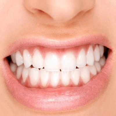 Teeth Grinding Treatment in Abu Dhabi & Al Ain Grinding Cost