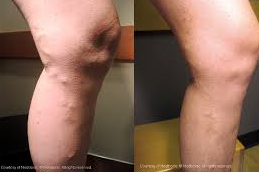 Vascular Surgery 5 Vascular Surgery