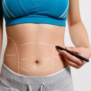 Waist Sculpting in Abu Dhabi