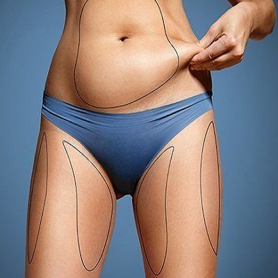 fat Transfer Surgery in Abu Dhabi