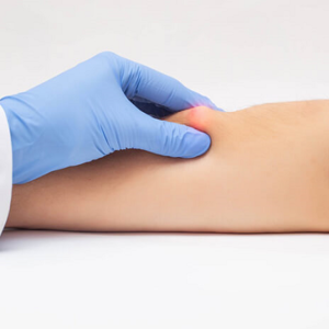 lipoma Treatment in Abu Dhabi