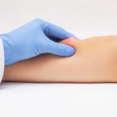 Lipoma Treatment Cost in Abu Dhabi 3 lipoma Treatment in Abu Dhabi