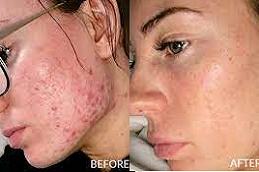 plexr plasmaClinic in Abu Dhabi & Al Ain