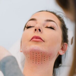 Blog 3 Belkyra Treatment Cost in Abu Dhabi