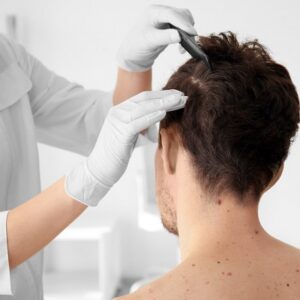 Best Dermatologist for Hair Loss in Abu Dhabi