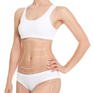 Blog 17 Bodytite Liposuction Cost in Abu Dhabi