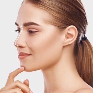 Blog 1 Hiko Nose Thread Lift Abu Dhabi UAE Price & Cost