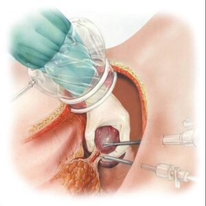 Blog 15 Laparoscopic Surgery Cost in Abu Dhabi