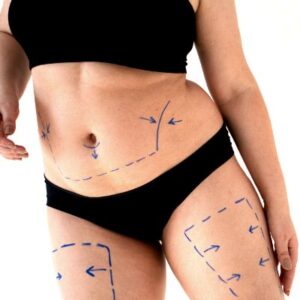 Lower Body Lift Cost in Abu Dhabi