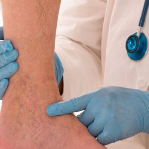 Vascular Surgery Cost in Abu Dhabi