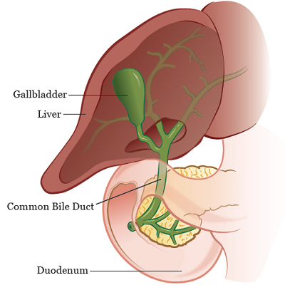 Bile Duct Cancer Treatment