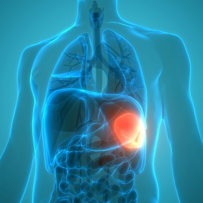 Splenomegaly Treatment 2 Splenomegaly Treatment in Abu Dhabi