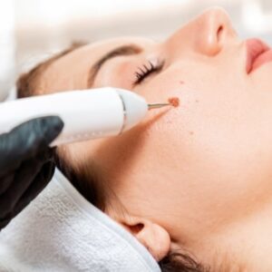 Blog 1 Xeomin Treatment Cost in Abu Dhabi