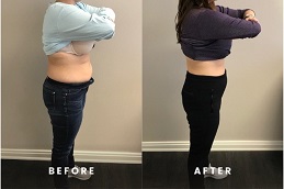 Mounjaro Treatment in abu dhabi