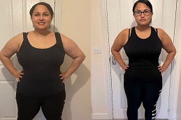 Allurion Gastric Balloon 5 before & after Allurion Gastric Balloon in abu dhabi