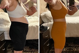 before & after Mounjaro Treatment