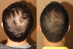 G Cell Treatment 8 g cell hair treatment in abu dhabi