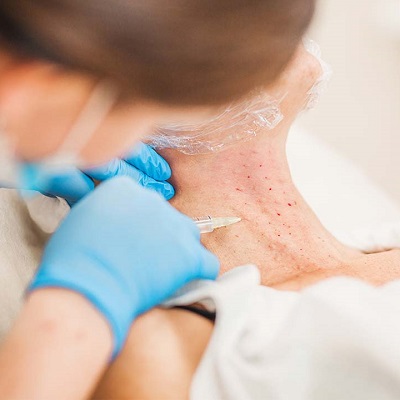 neck-botox-injections