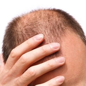 Exploring The Power of G Cell Treatment