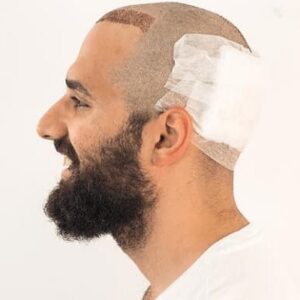 Blog 1 The Complete Guide to Hair Transplant Surgery What to Expect