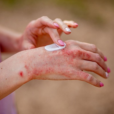 Ecezma treatment in abu dhabi