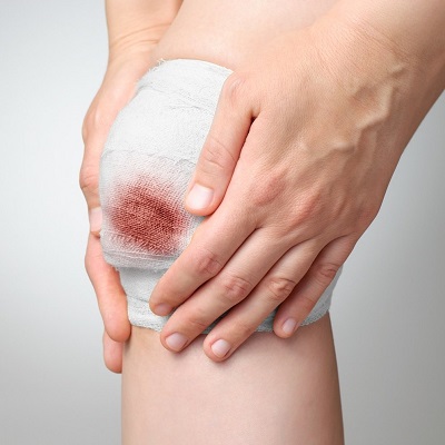 Get Wound Cleaned at Home 2 Get Wound Cleaned at Home