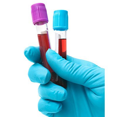 Get a Blood Test at home