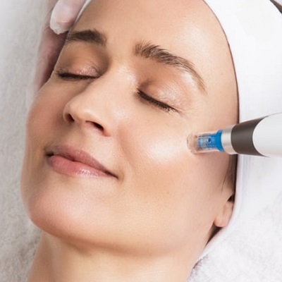 How Much Does Dermapen Cost for your Face? 2 How much does dermapen cost for your face