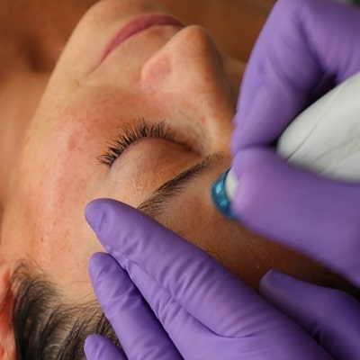 5 Reasons Why HydraFacial is So Popular Right Now 10 5 Reasons Why HydraFacial is So Popular Right Now