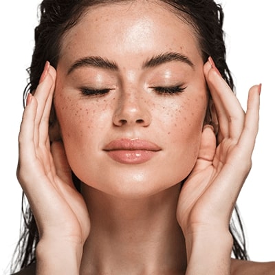 Melasma Treatment in Abu Dhabi