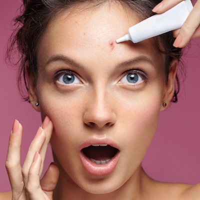 Acne Treatment Cost in Abu Dhabi