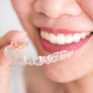 Blog 11 Hollywood Smile Price UAE