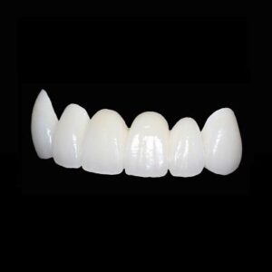 Blog 5 Zirconia Crown Price UAE