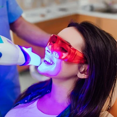 Nano Teeth Whitening 2 Nano Teeth Whitening in Abu Dhabi