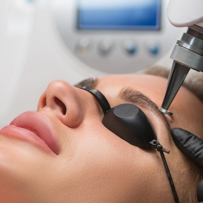 Eyebrow Tattoo Removal